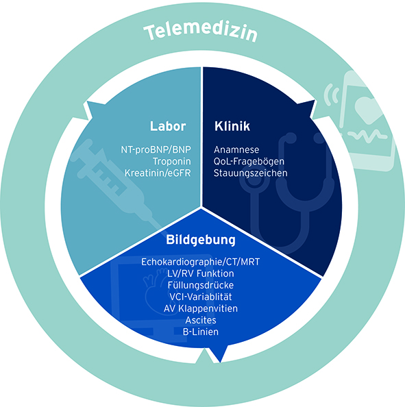 neuer-leitfaden-zur-instabilen-herzinsuffizienz
